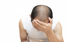 best hair loss treatment clinic in Delhi